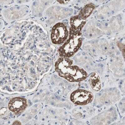 Immunohistochemistry-Paraffin: HPRT Antibody [NBP1-92006]
