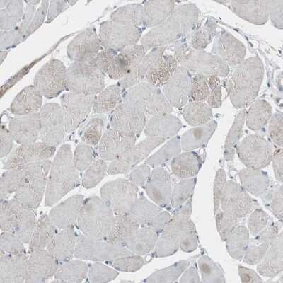 Immunohistochemistry-Paraffin: HPRT Antibody [NBP1-92006]