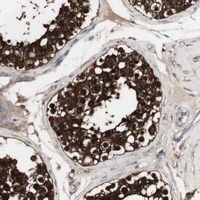 Immunohistochemistry-Paraffin: HPRT Antibody [NBP1-92006]