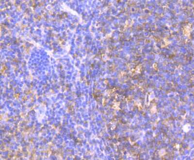 Immunohistochemistry-Paraffin: HPRT Antibody (JU03-26) [NBP2-75528]