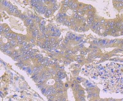 Immunohistochemistry-Paraffin: HPRT Antibody (JU03-26) [NBP2-75528]