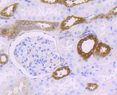 Immunohistochemistry-Paraffin: HPRT Antibody (JU03-26) [NBP2-75528]