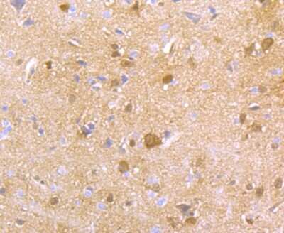 Immunohistochemistry-Paraffin: HPRT Antibody (JU03-26) [NBP2-75528]