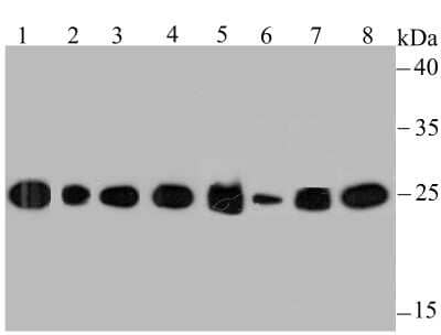 Western Blot: HPRT Antibody (JU03-26) [NBP2-75528]