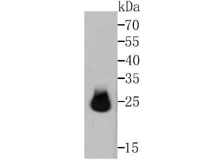 Western Blot: HPRT Antibody (JU03-26) [NBP2-75528]