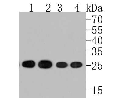 Western Blot: HPRT Antibody (JU03-26) [NBP2-75528]