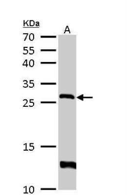 Western Blot: HPRT Antibody [NBP1-33527]