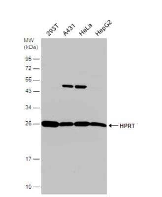 Western Blot: HPRT Antibody [NBP1-33527]