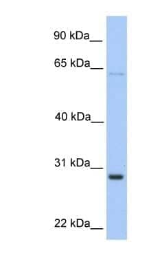 Western Blot: HPRT Antibody [NBP1-52903]