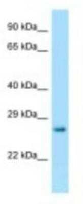 Western Blot: HPRT Antibody [NBP1-98359]