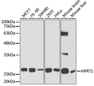 Western Blot: HPRT AntibodyBSA Free [NBP3-03361]