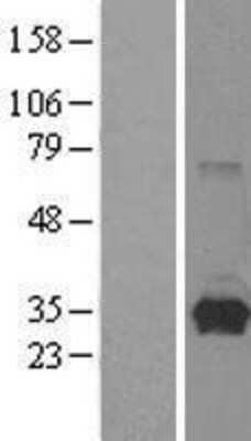 Western Blot: HPRT Overexpression Lysate [NBL1-11696]