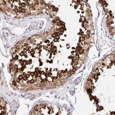 Immunohistochemistry-Paraffin: HPS1 Antibody [NBP2-31848]