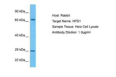 Western Blot: HPS1 Antibody [NBP2-85078]