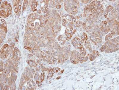 Immunohistochemistry-Paraffin: HPS3 Antibody [NBP1-31061]