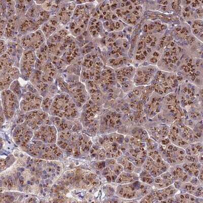 Immunohistochemistry-Paraffin: HPS3 Antibody [NBP1-92007]