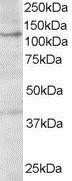 Western Blot: HPS3 Antibody [NB100-1445]