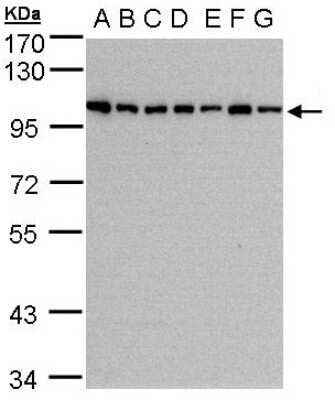 Western Blot: HPS3 Antibody [NBP1-31061]