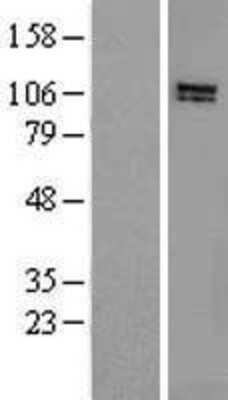 Western Blot: HPS3 Overexpression Lysate [NBL1-11697]