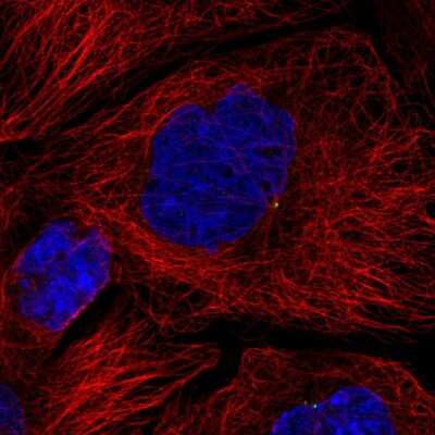 Immunocytochemistry/ Immunofluorescence: HPS4 Antibody [NBP2-31898]