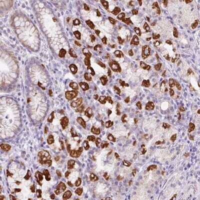 Immunohistochemistry: HPS4 Antibody [NBP2-31898]