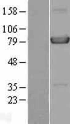 Western Blot: HPS4 Overexpression Lysate [NBL1-11698]