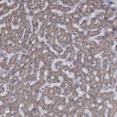 Immunohistochemistry-Paraffin: HPS5 Antibody [NBP3-17593]
