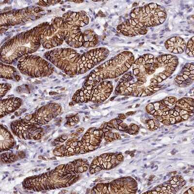 Immunohistochemistry-Paraffin: HPS6 Antibody [NBP2-14100]