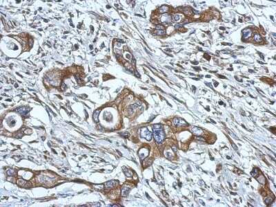 Immunohistochemistry-Paraffin: HPS6 Antibody [NBP2-16877]