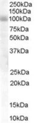 Western Blot: HPS6 Antibody [NB300-931]