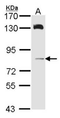 Western Blot: HPS6 Antibody [NBP1-33681]