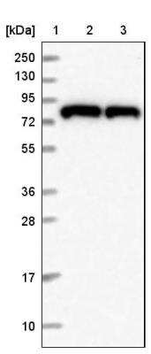 Western Blot: HPS6 Antibody [NBP2-14100]