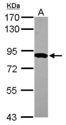 Western Blot: HPS6 Antibody [NBP2-16877]