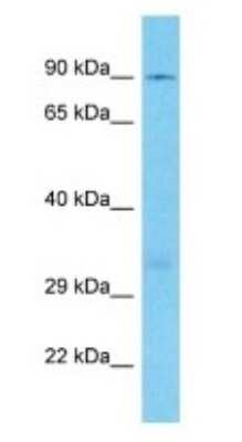 Western Blot: HPS6 Antibody [NBP3-09459]