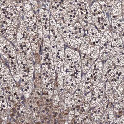 Immunohistochemistry-Paraffin: HPSC152 Antibody [NBP1-92008]
