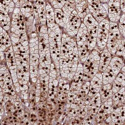 Immunohistochemistry-Paraffin: HPSC152 Antibody [NBP1-92009]