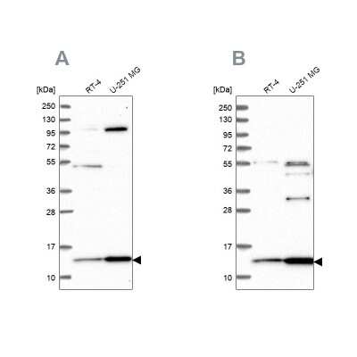 Western Blot: HPSC152 Antibody [NBP1-92008]