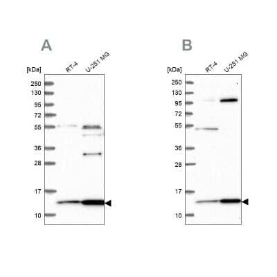 Western Blot: HPSC152 Antibody [NBP1-92009]