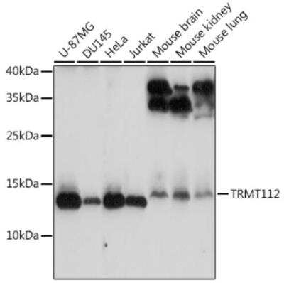 Western Blot: HPSC152 AntibodyAzide and BSA Free [NBP3-03251]