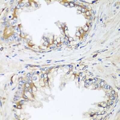 Immunohistochemistry-Paraffin: HPSE2 Antibody - BSA Free [NBP3-05028]