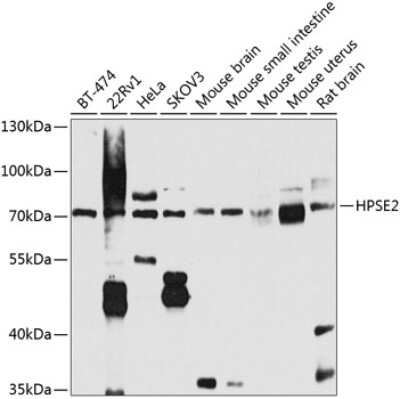 Western Blot: HPSE2 AntibodyBSA Free [NBP3-05028]