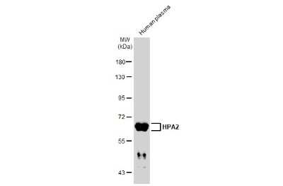 Western Blot: HPSE2 Antibody [NBP3-13420]