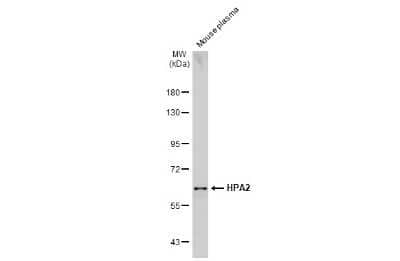 Western Blot: HPSE2 Antibody [NBP3-13420]