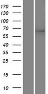 Western Blot: HPSE2 Overexpression Lysate [NBP2-06517]