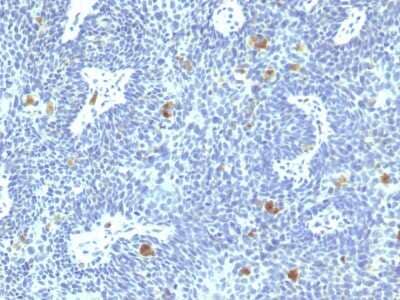 Immunohistochemistry-Paraffin: HPV16 Antibody (HPV16/1295) - Azide and BSA Free [NBP3-08758]