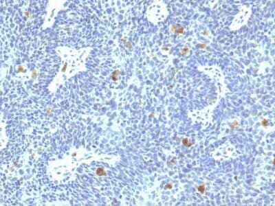 Immunohistochemistry-Paraffin: HPV16 Antibody (HPV16/1295) [NBP3-07844]