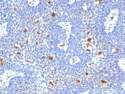 Immunohistochemistry-Paraffin: HPV16 Antibody (HPV16/1296) [NBP2-53374]