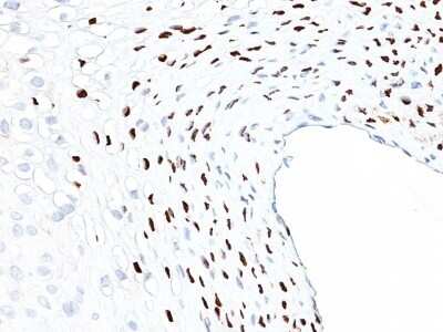 Immunohistochemistry-Paraffin: HPV16 Antibody (HPV16L1/1058) [NBP2-45208]