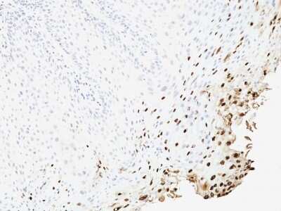 Immunohistochemistry-Paraffin: HPV16 Antibody (SPM257) [NBP3-07791]