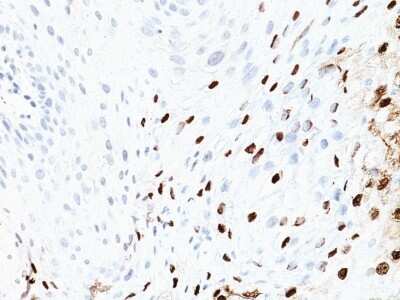 Immunohistochemistry-Paraffin: HPV16 Antibody (SPM405) [NBP2-45191]